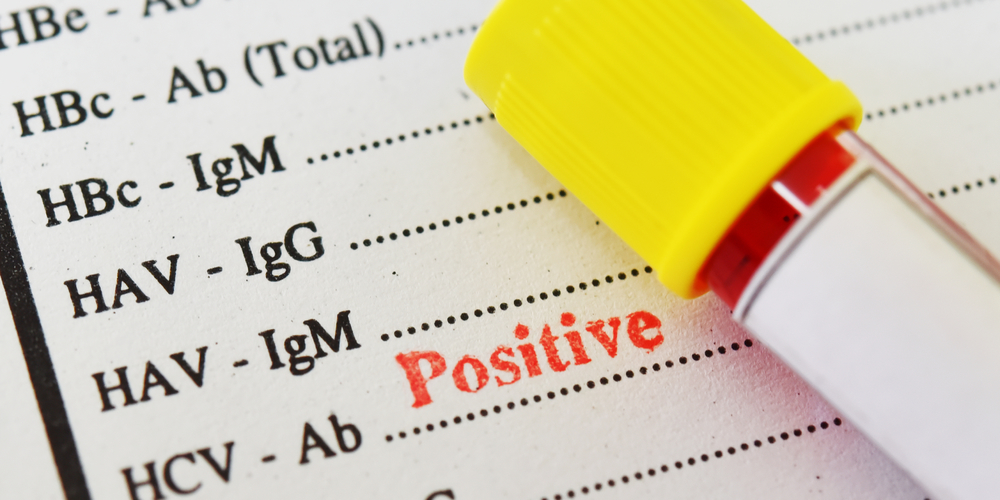 How Accurate Are Home STD Tests? A Doctor Breaks It Down