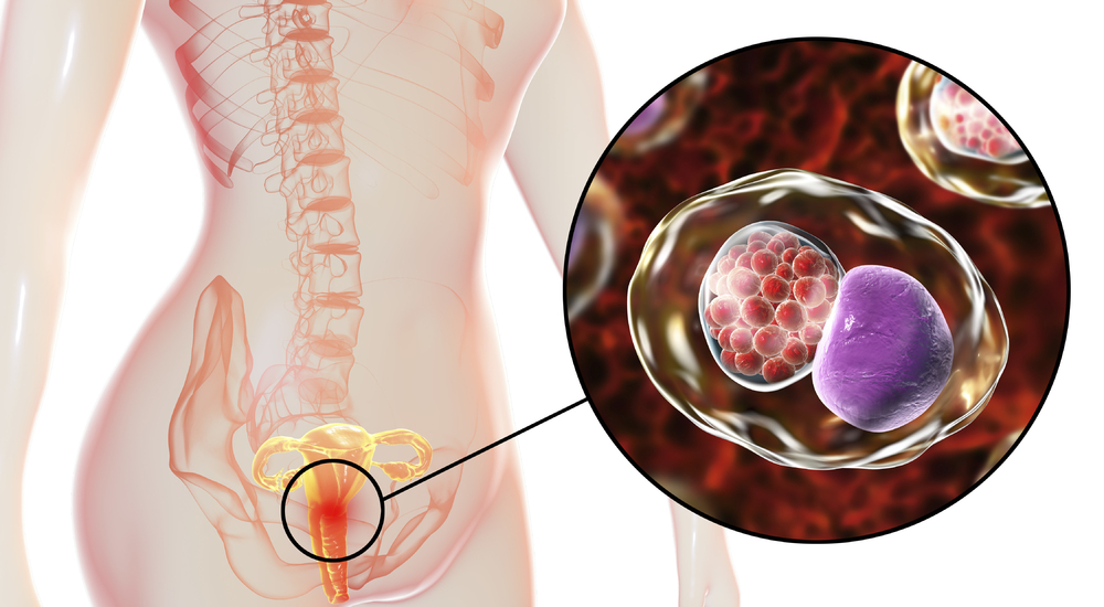 Vaginal Discharge: Its Relationship to Women's Health