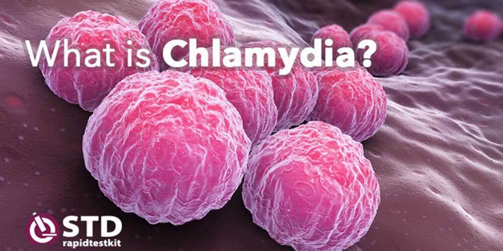 stuffed chlamydia
