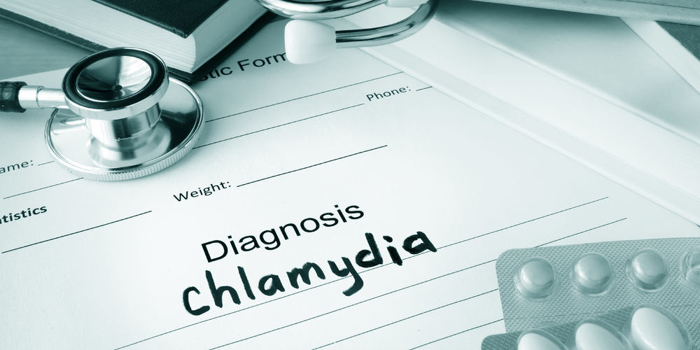 Chlamydia symptoms in men