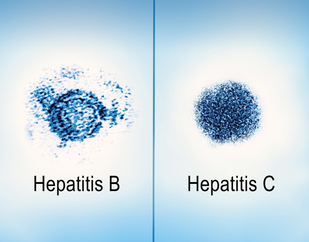 Hepatitis B vs C: How to Tell the Difference, Get Tested, and Stay Safe
