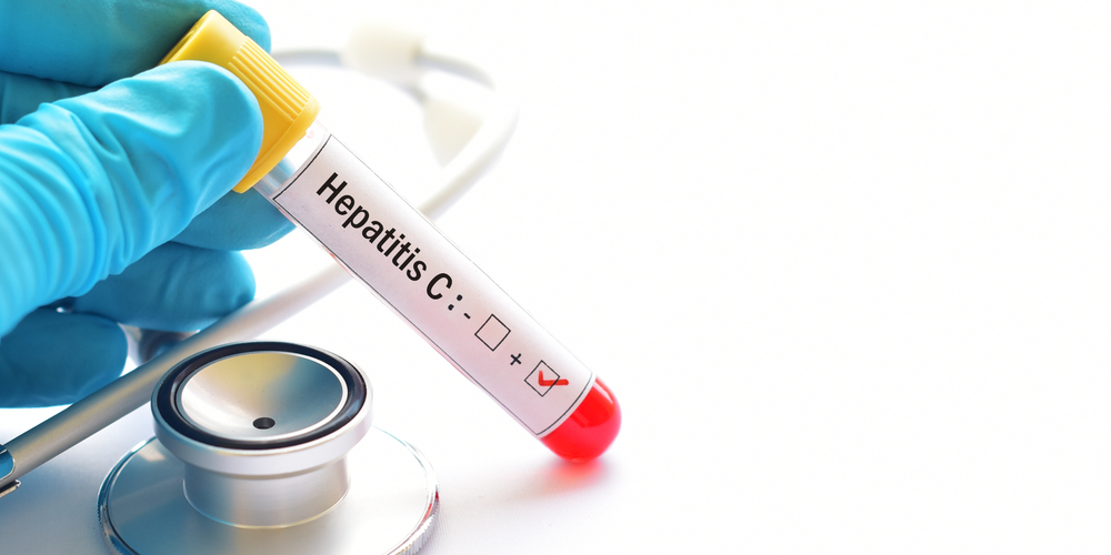 Be Alert: 7 Key Symptoms of Hepatitis C