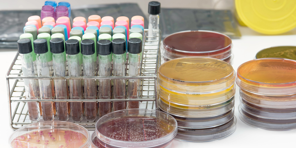 Mycoplasma Genitalium: Symptoms, Treatments, & Prevention Strategies for this Silent STI