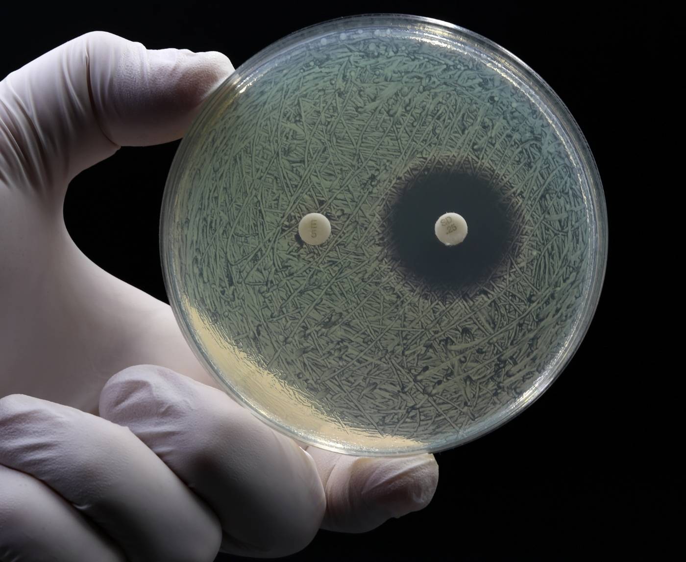 No Symptoms, No Problem? Not With Gonorrhea in 2025