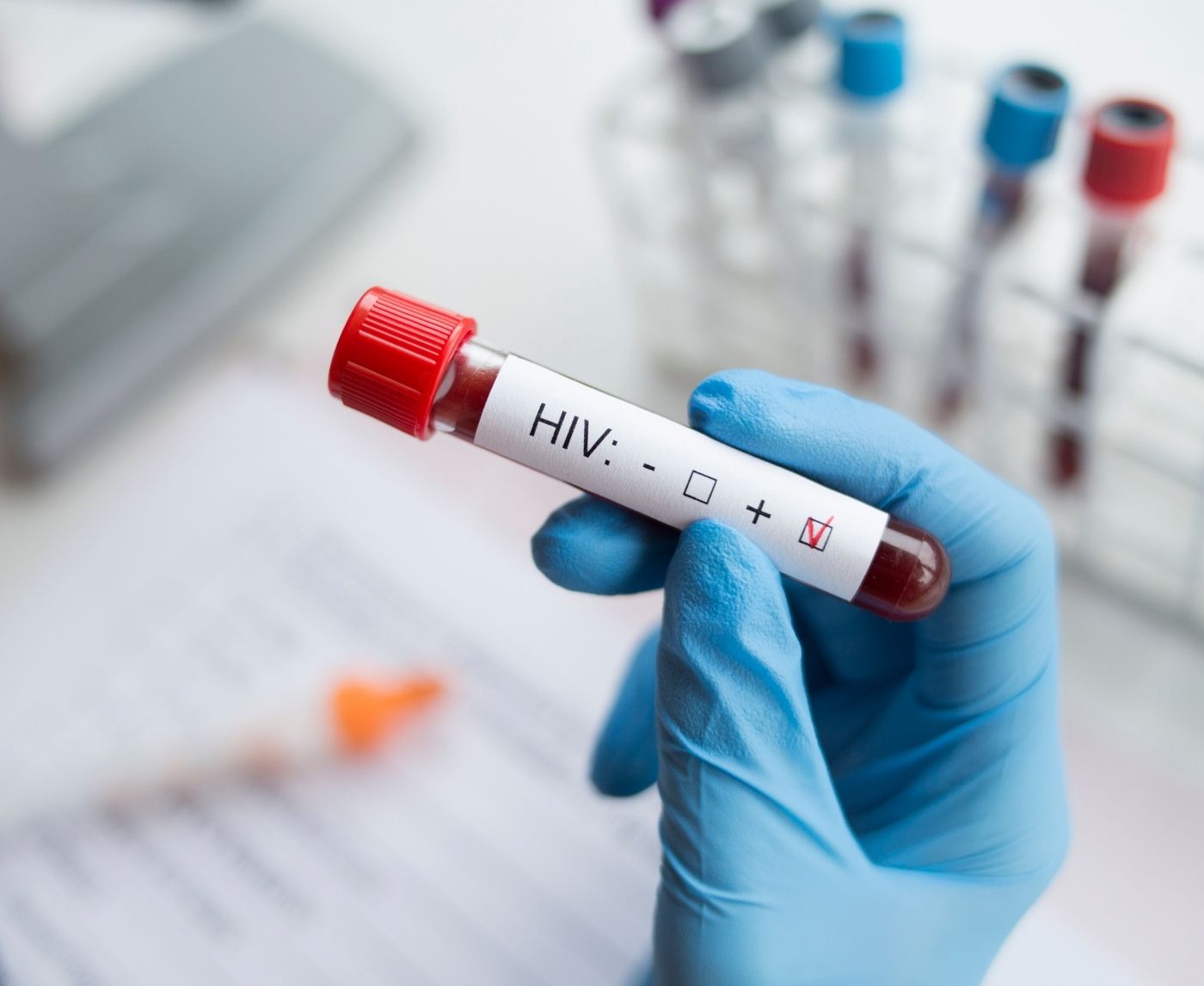 The Silent Virus: Why HIV Symptoms Get Missed for Years