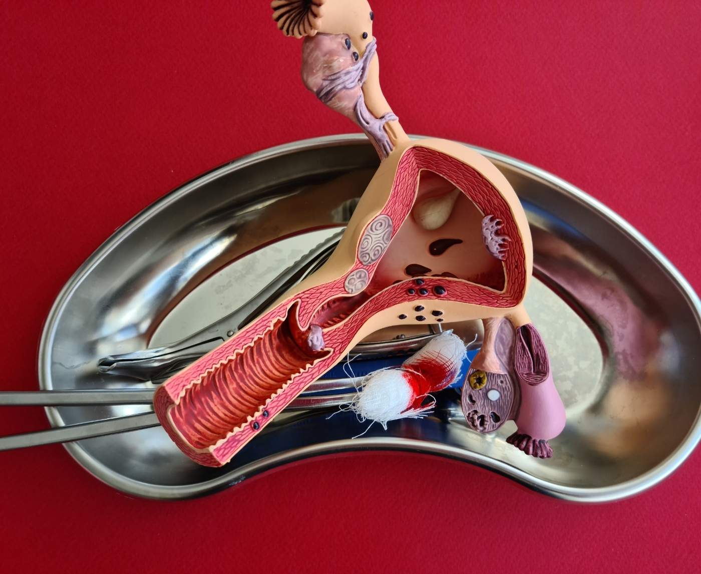 Long-term STDs Can Increase Your Risk for Urogenital Cancers