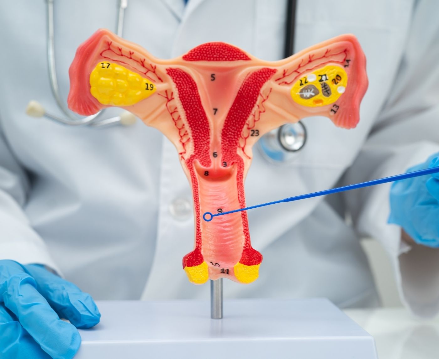 I Was Told I Have a Strawberry Cervix, Should I Panic?