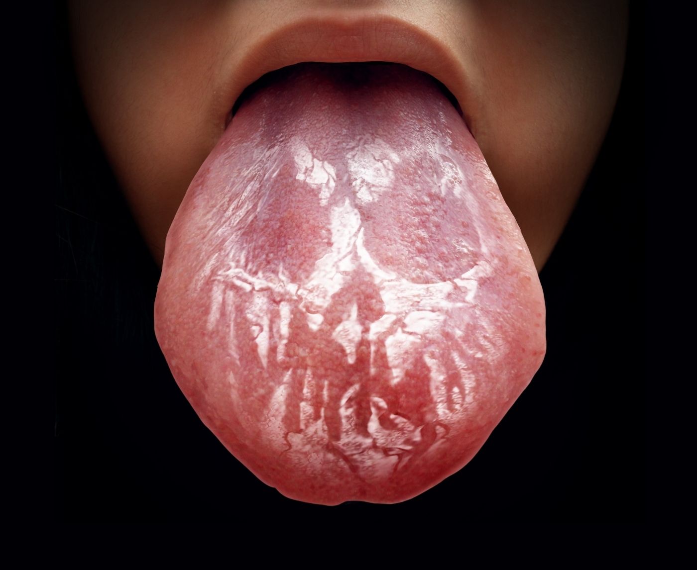 The Truth About Oral Sex and STD Risks. You Can Catch More Than Just Feelings