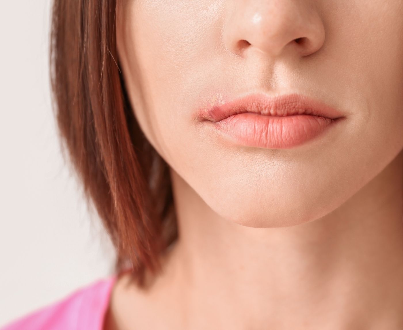 Will Vaseline Make a Cold Sore Heal Faster? Here’s the Truth