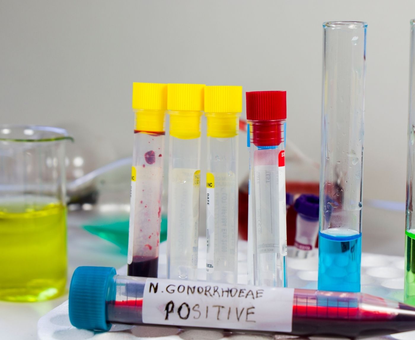 Still Positive After STD Treatment? Here’s When to Retest