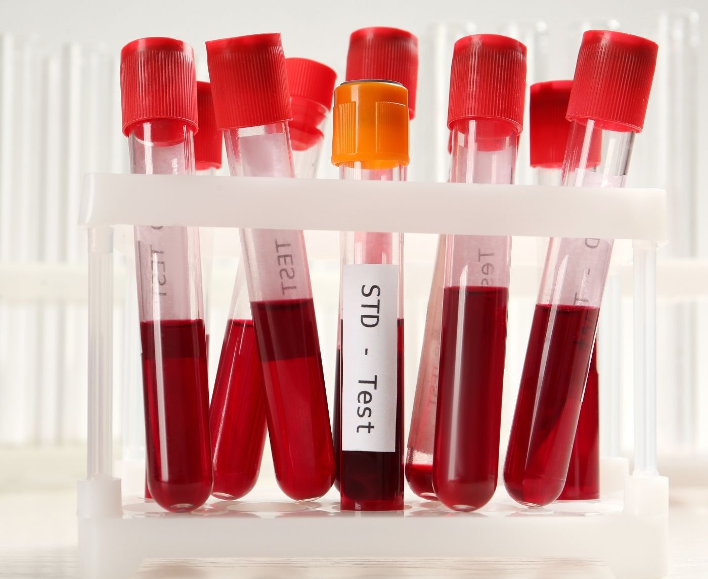 I Tested Positive for Gonorrhea, Here’s What Actually Happens Next