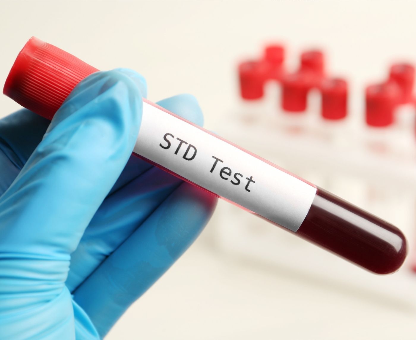 Can Chlamydia Come Back After Treatment? Here’s What You Need to Know