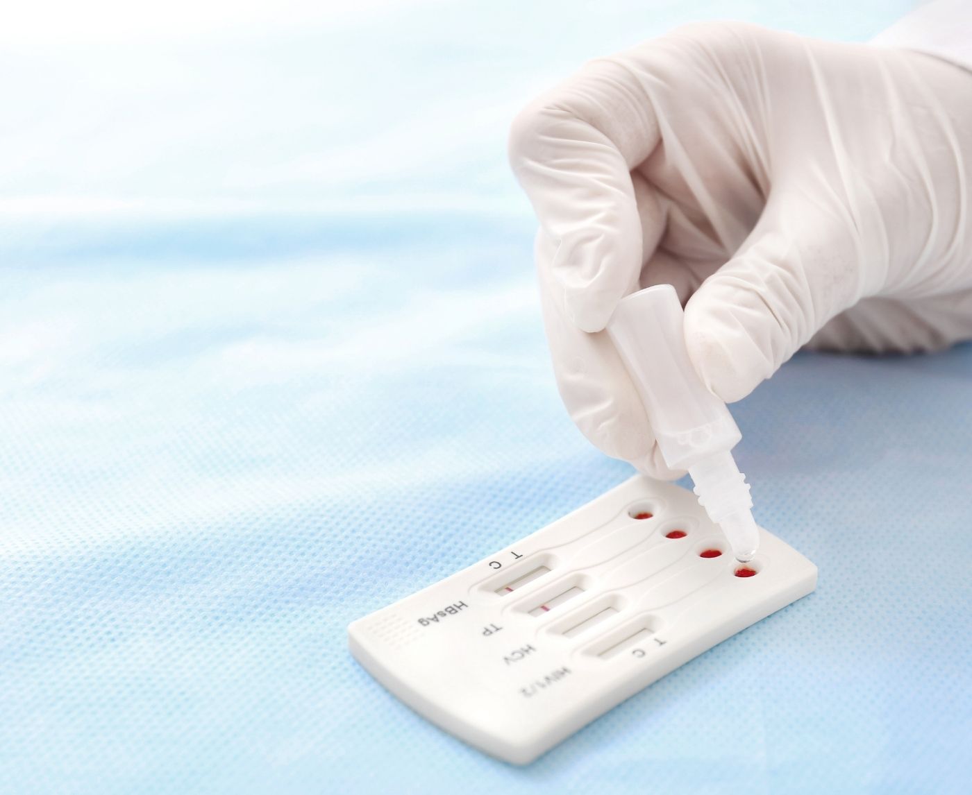 STD Testing Without the Judgy Doctor: How At-Home Kits Changed Everything