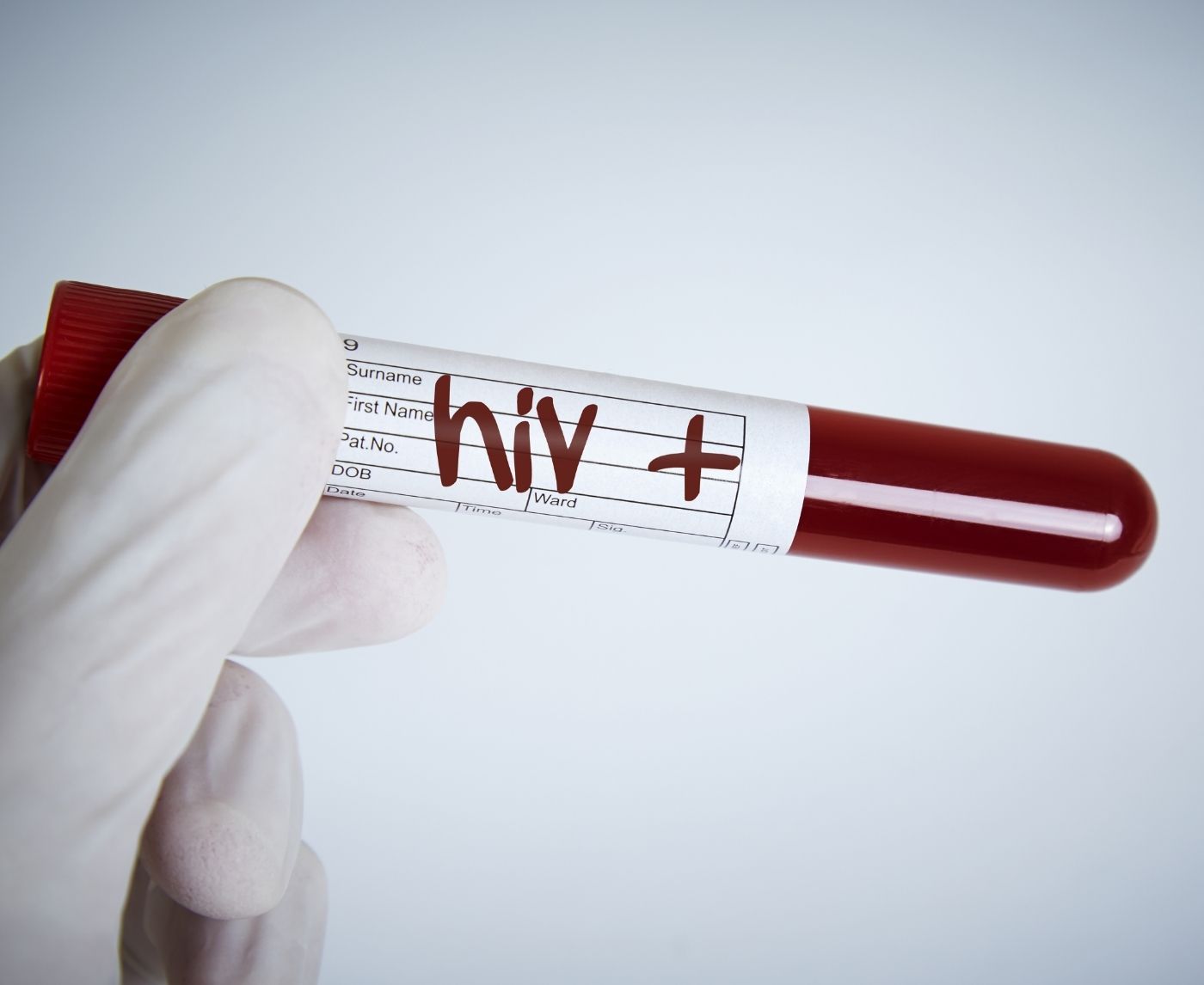 The Future of HIV Self-Testing Kits: At-Home Hope or Hidden Risk?