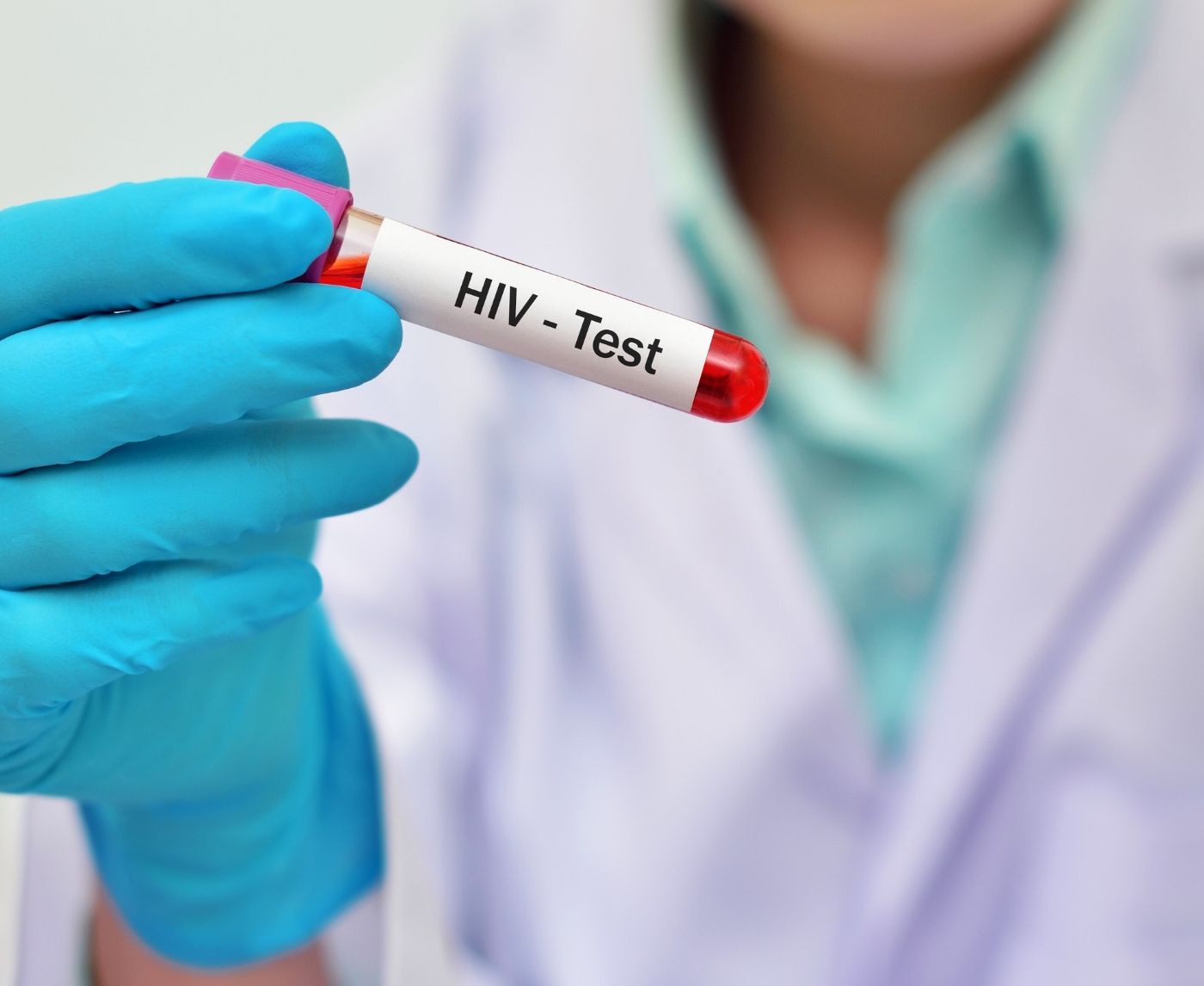 At-Home HIV Test or Lab Work: What Actually Gives You Peace of Mind
