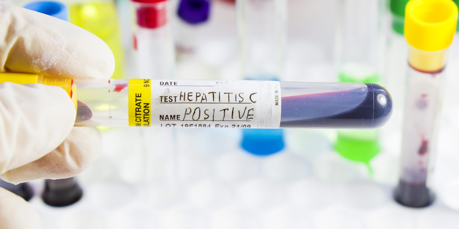 Hepatitis C Transmission: How Does Hepatitis C Spread?