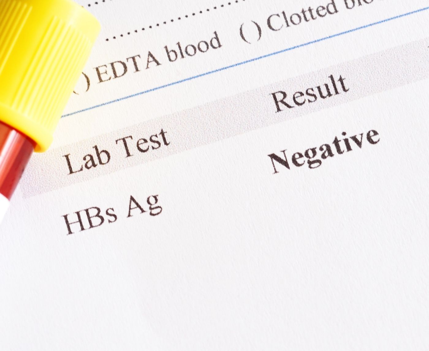 You Tested Negative for Hepatitis B. Here’s Why That Might Be Wrong