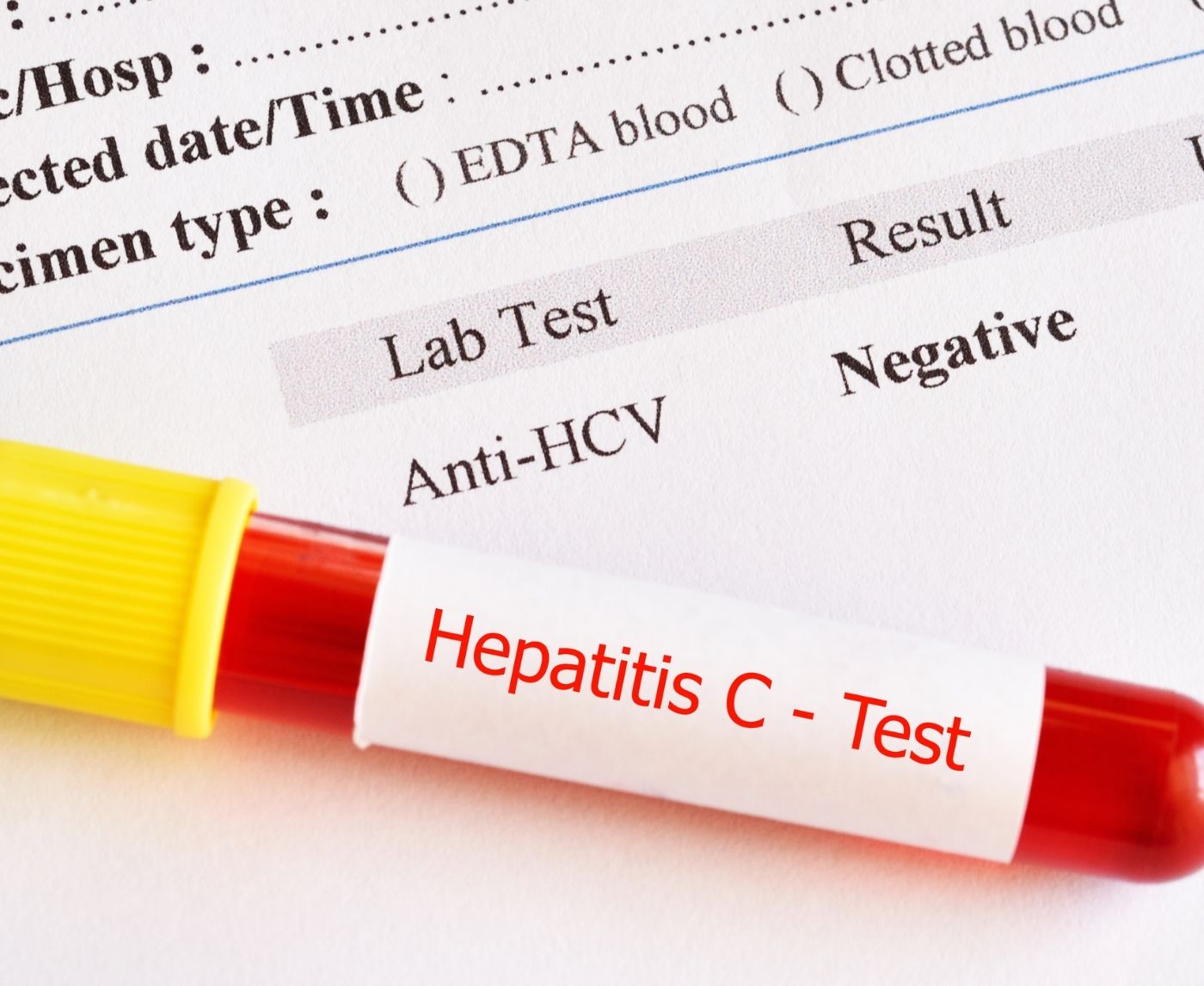 Hepatitis C Rapid Test Results: What That Line Really Means