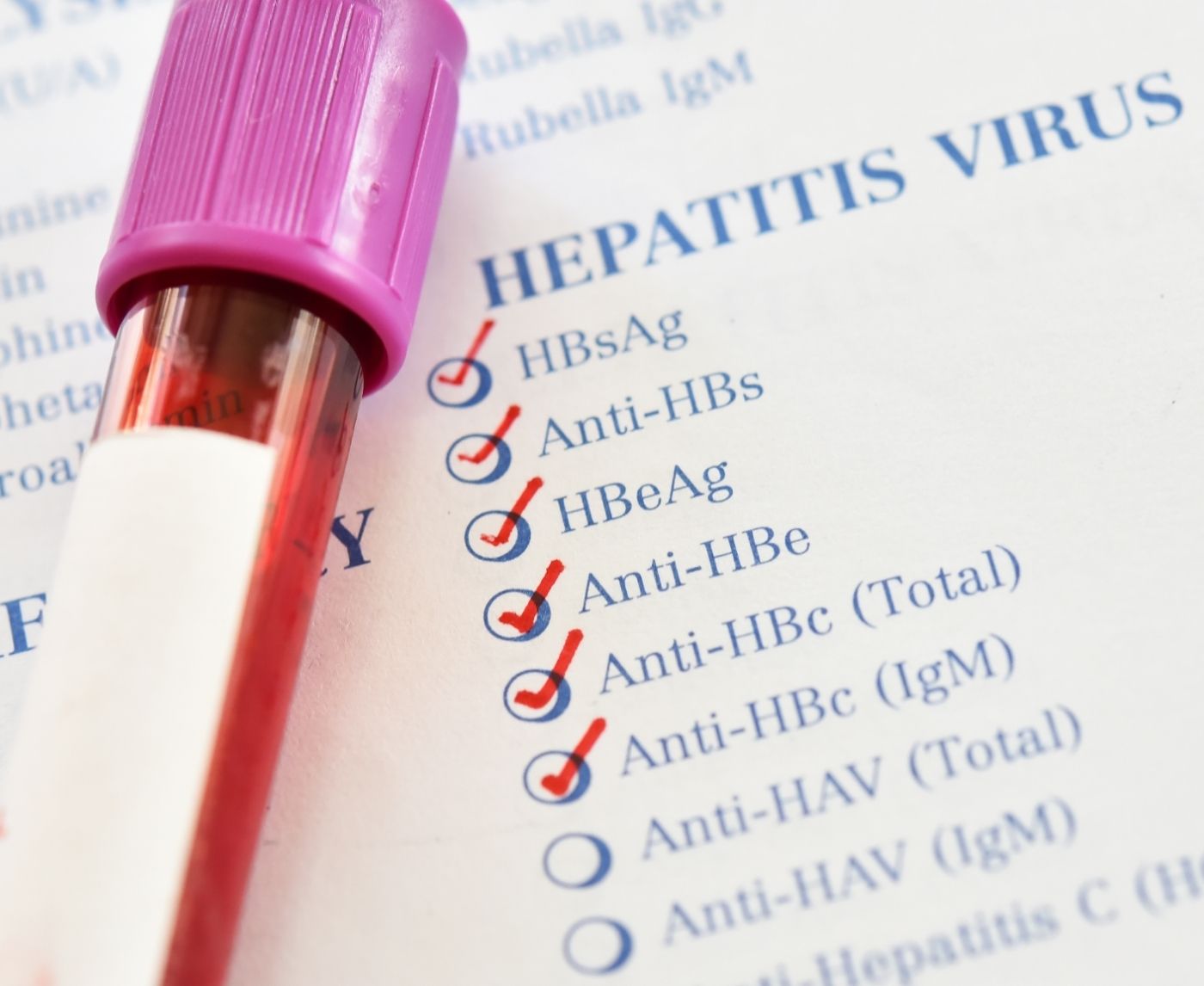 Why Hep B Testing Should Be Part of Every STD Panel (But Usually Isn’t)