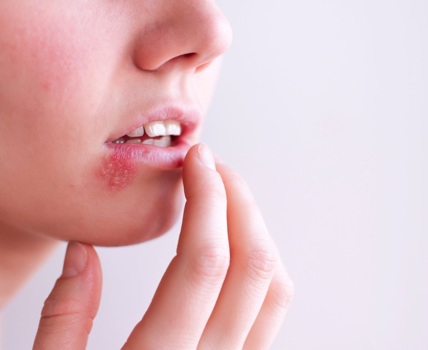 Herpes and Hormones: Can Birth Control Trigger Outbreaks?