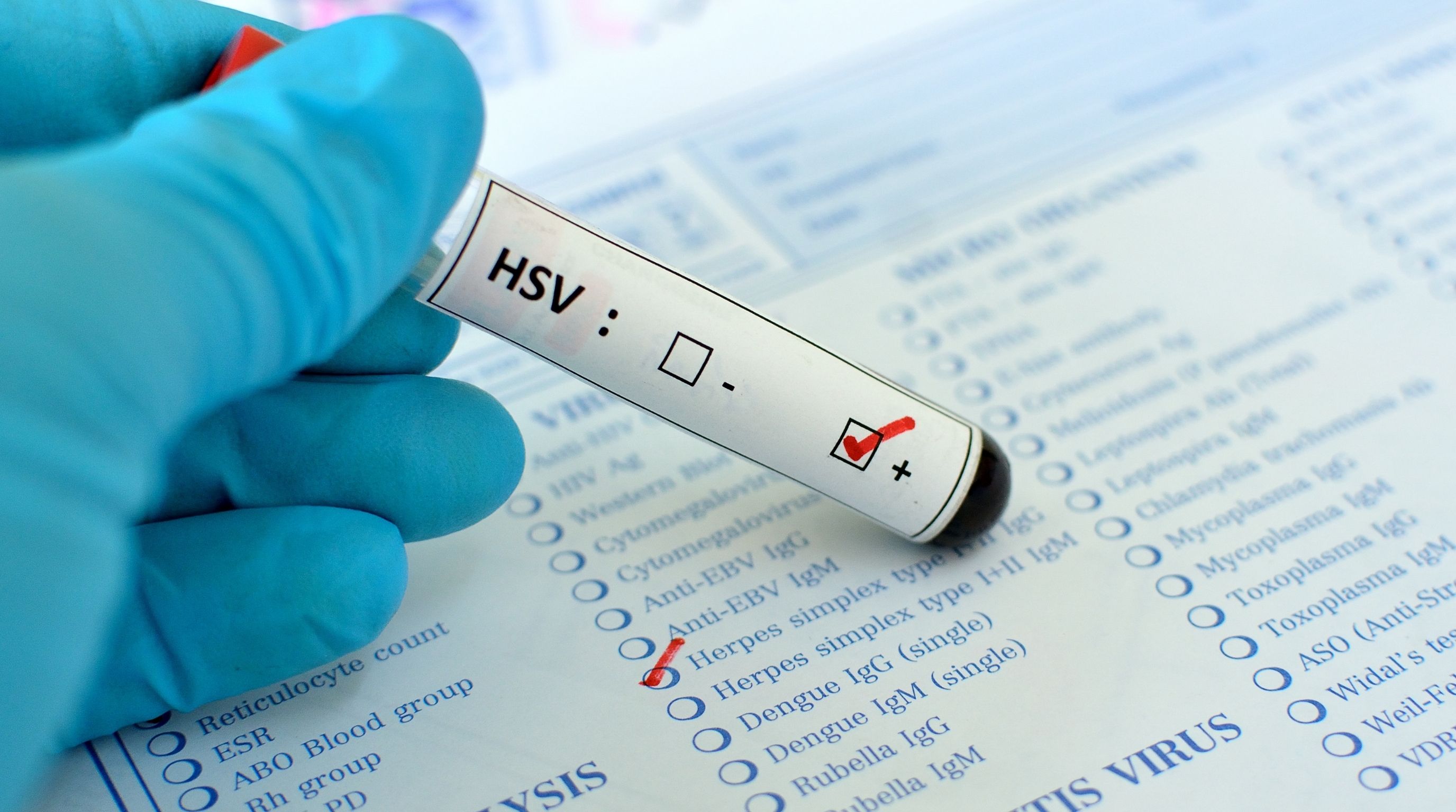 Why Herpes Testing Isn’t Routine, and What to Do About It