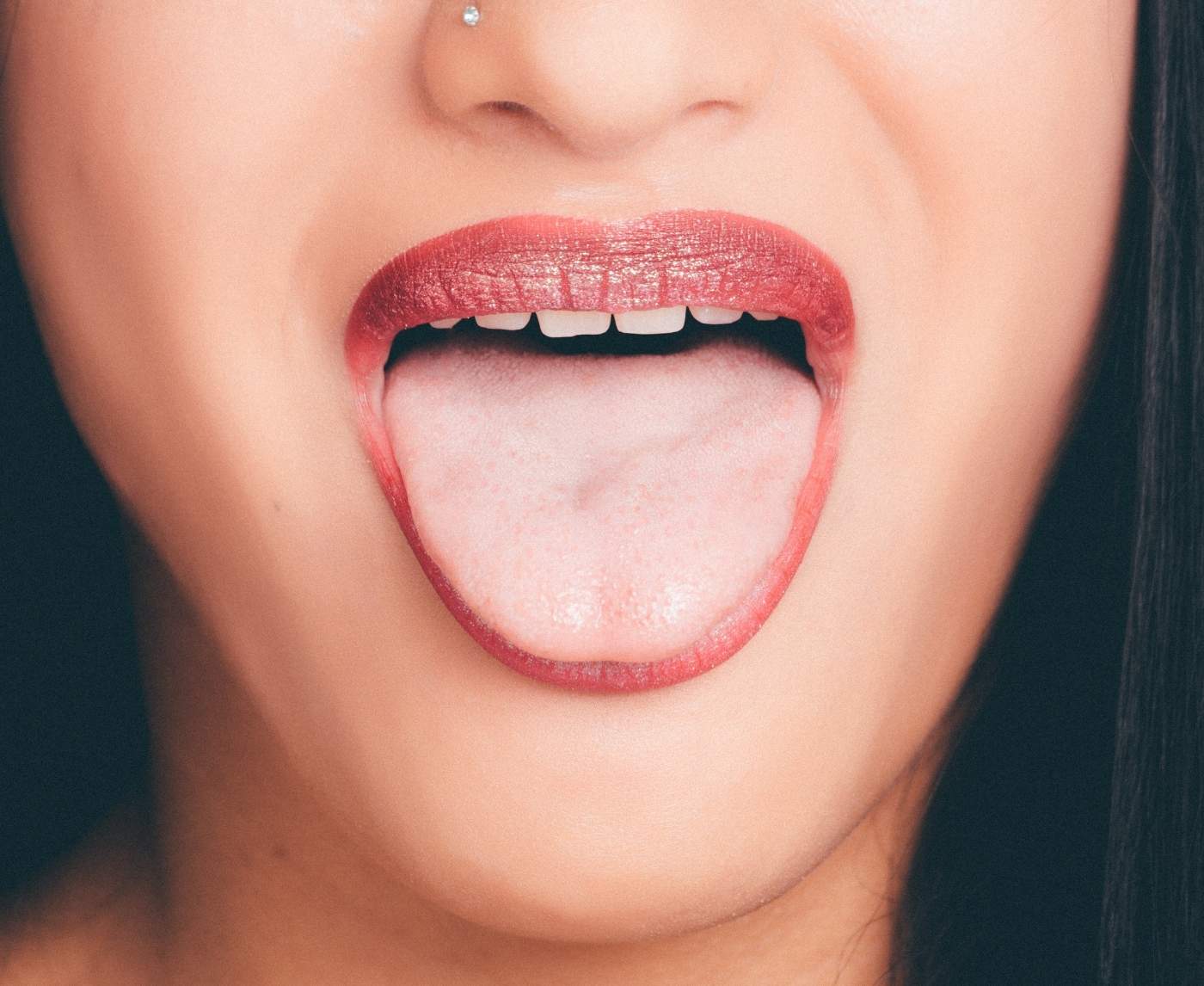 Yellow Tongue, Bleeding Gums, No Idea Why? This Could Be Hepatitis B