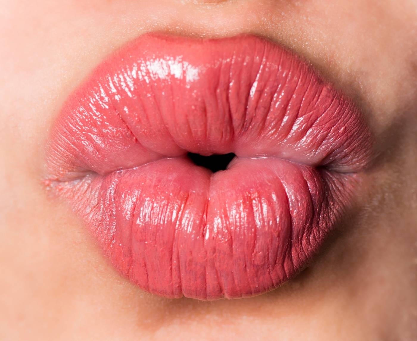 Dating With Herpes: Stories, Stats, and Zero Shame