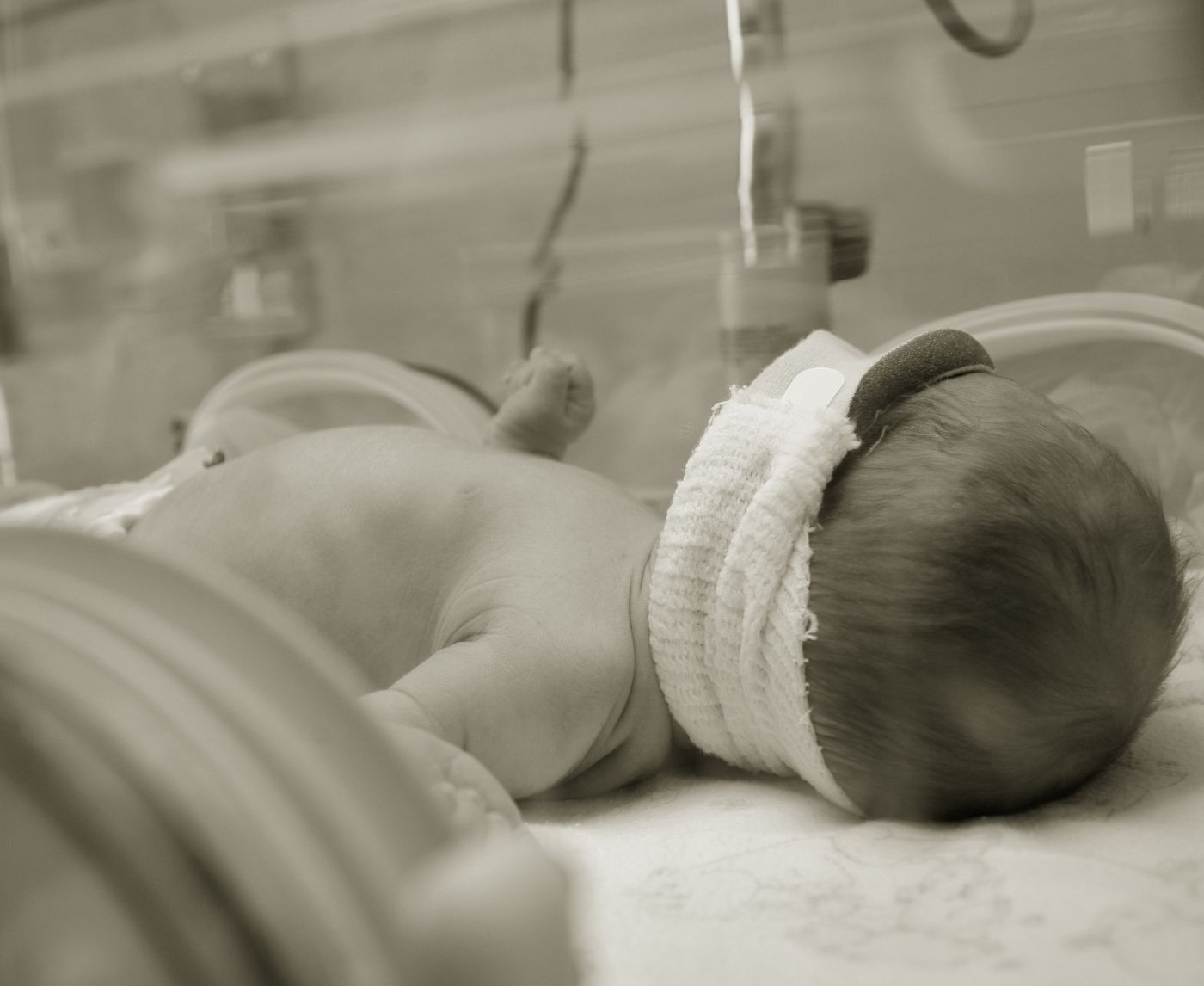 The Impact of Syphilis on Infants: The Significance of Prenatal Care