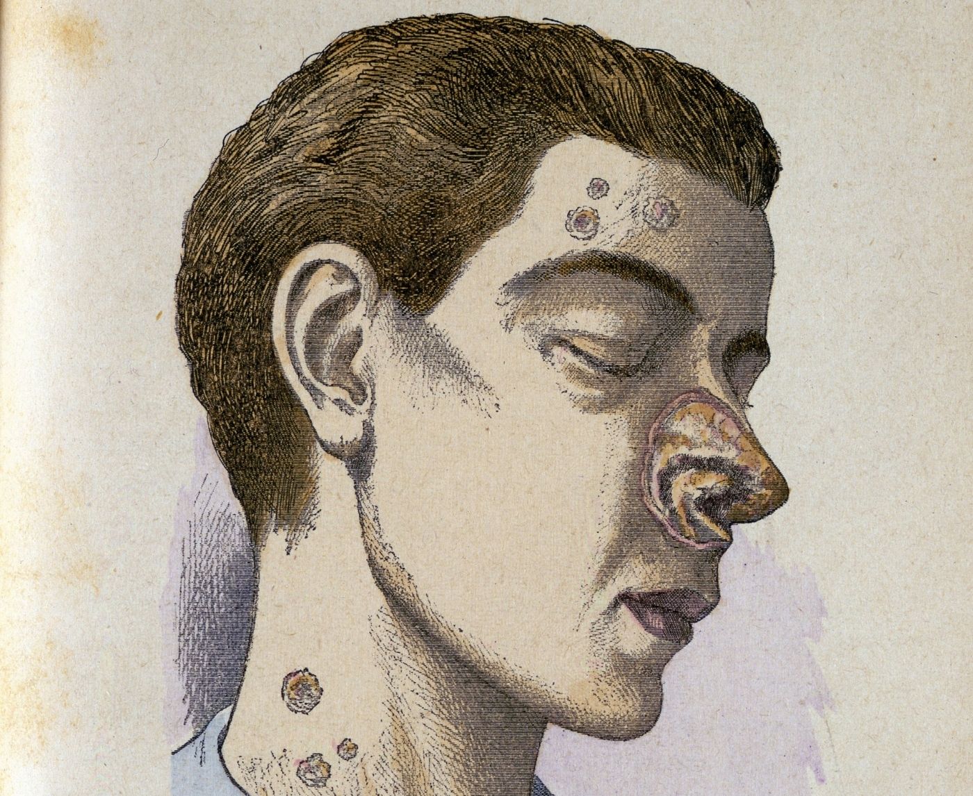 From Plagues of Love to Home Test Kits: The Real History of STDs