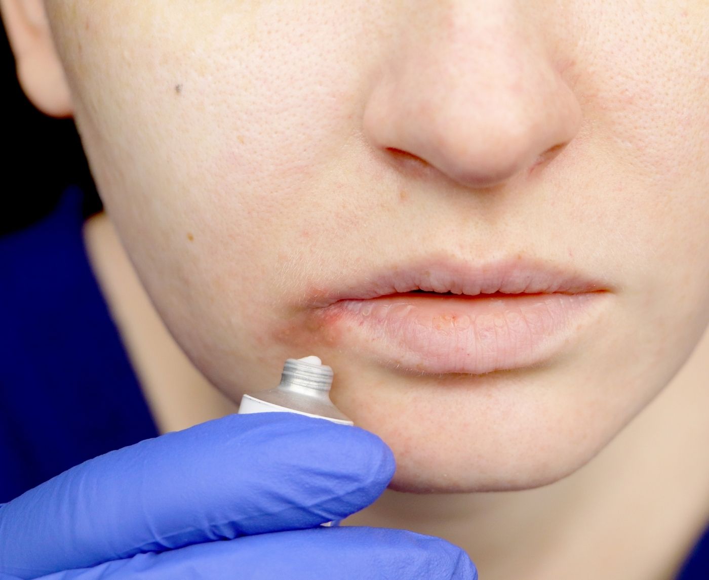 Burning, Bumps, or Nothing at All? What STD Symptoms Really Look Like