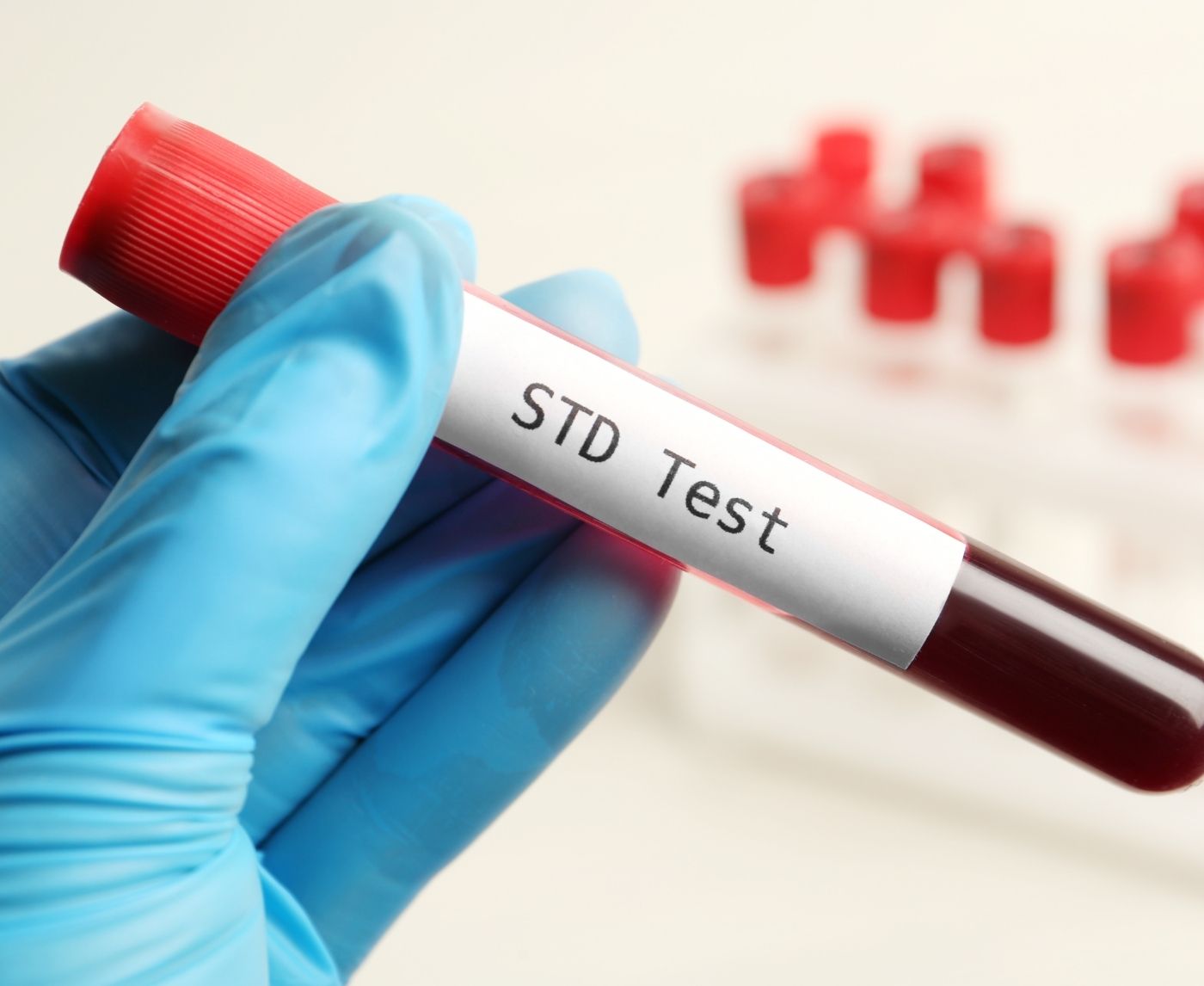 Why Some STDs Don’t Show Up on Standard Tests (And What to Do About It)