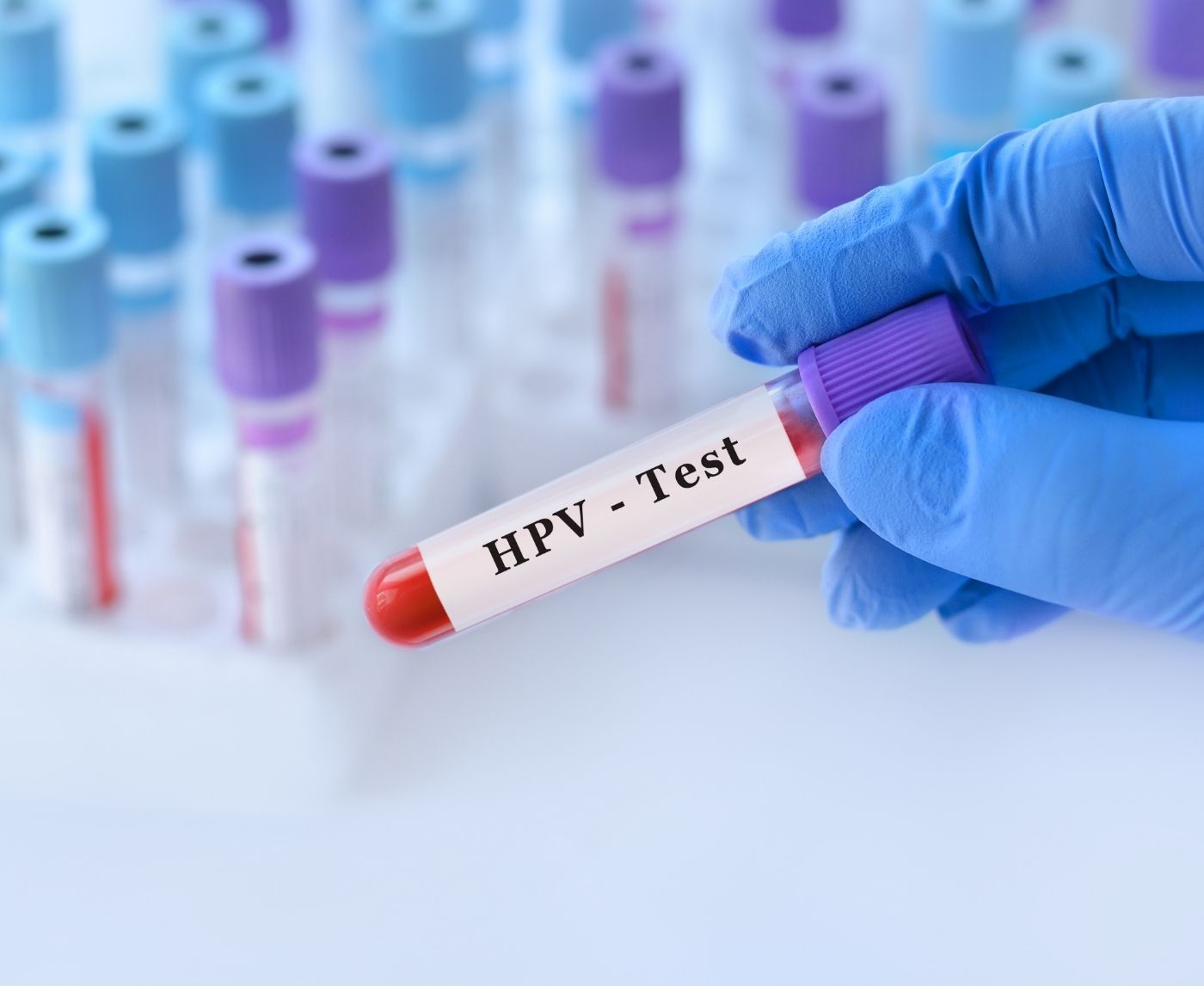 Why STD Rates Are Rising Fast, and What You Can Do to Protect Yourself