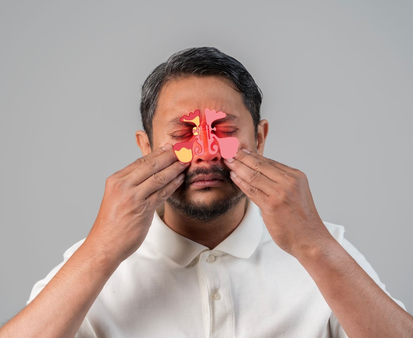 It Wasn’t a Sinus Infection, It Was Syphilis in My Nose