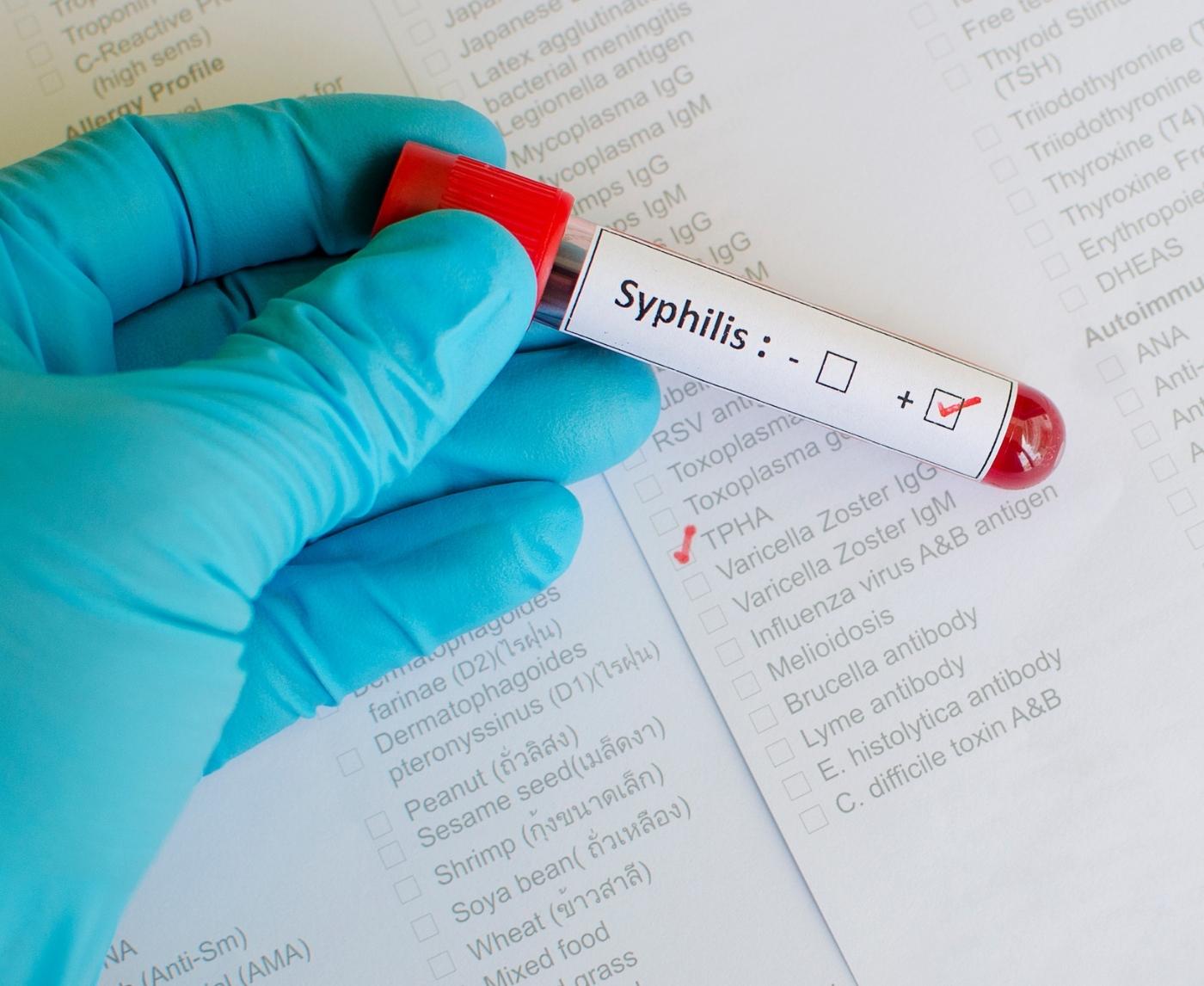 Syphilis With No Symptoms? Here's Why It Happens