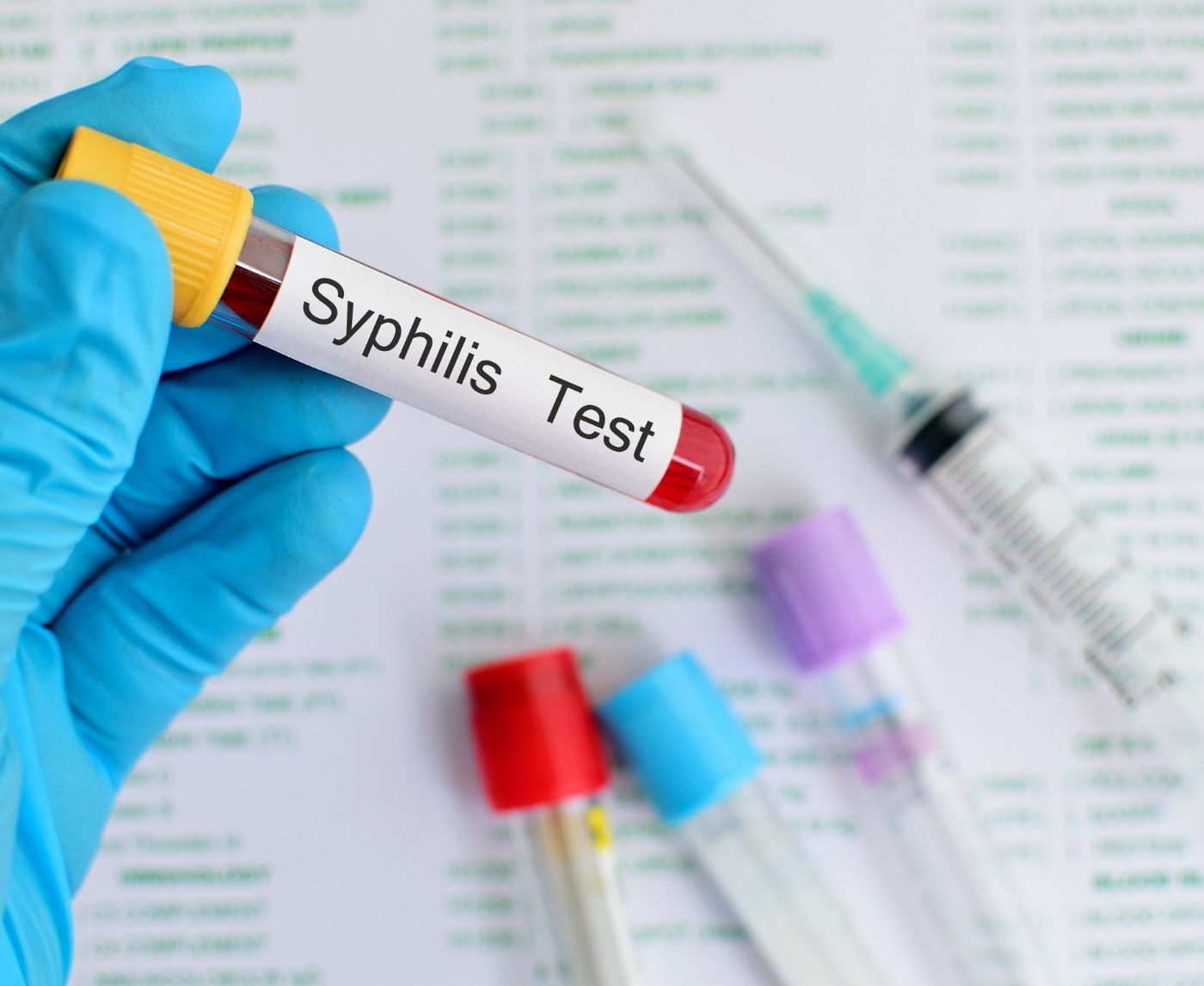 Best Syphilis Home Tests What Works, What Doesn’t