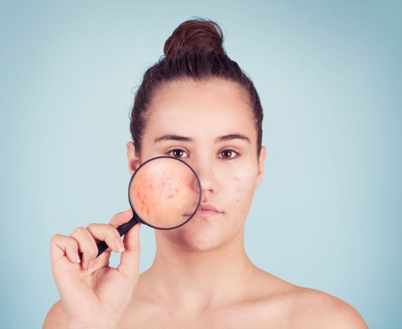 Why Does Herpes Never Go Away?