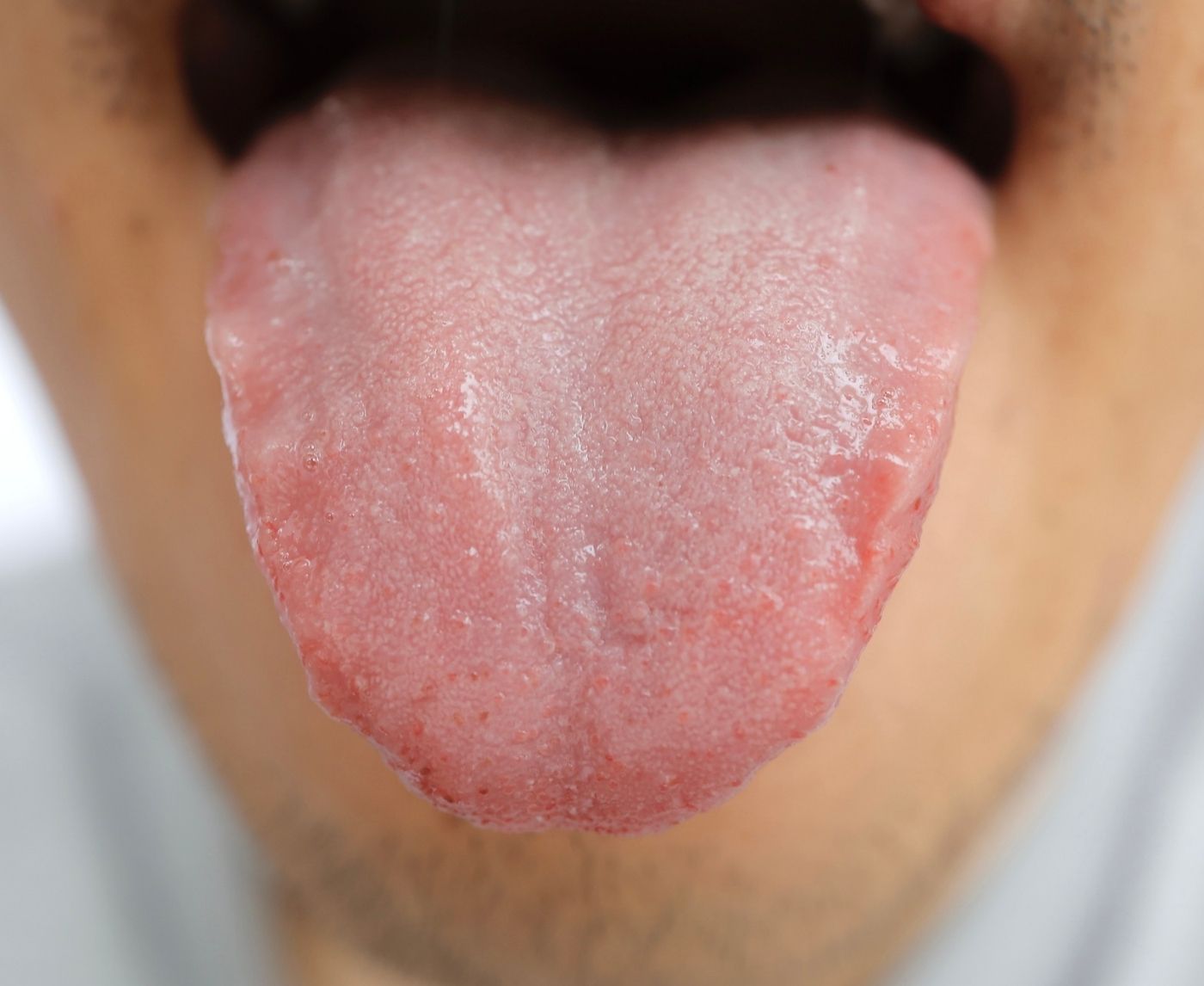 Dad Who Nearly Lost Tongue to Cancer Urges Men to Take HPV Testing Seriously