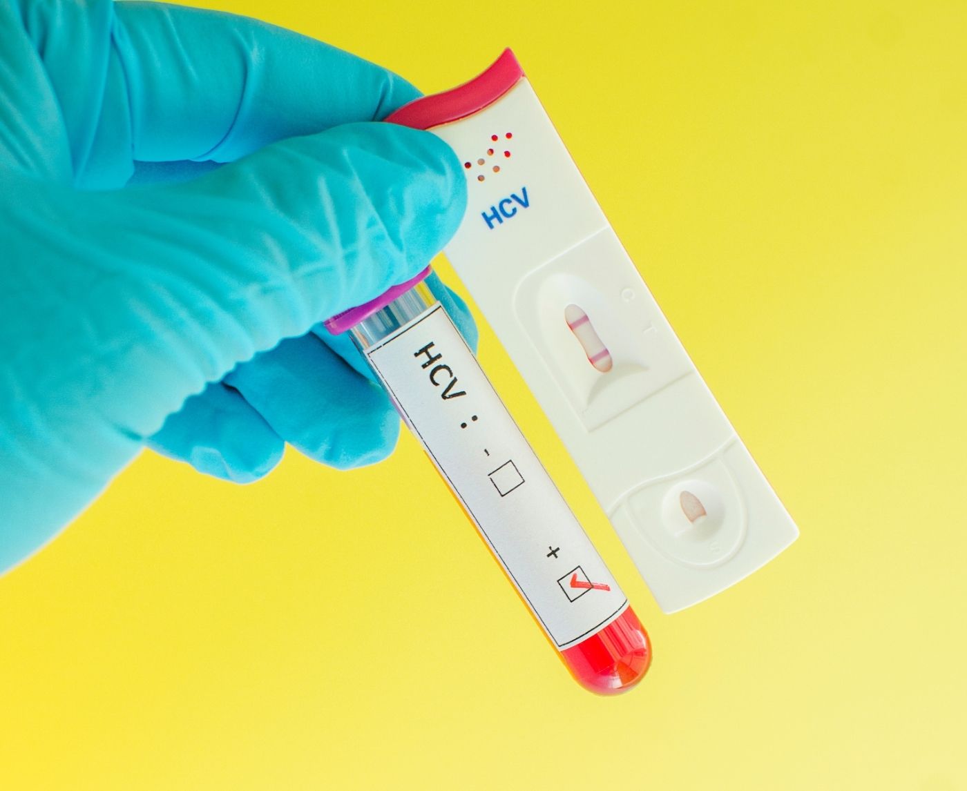 The Growing Demand for At-Home STD Tests
