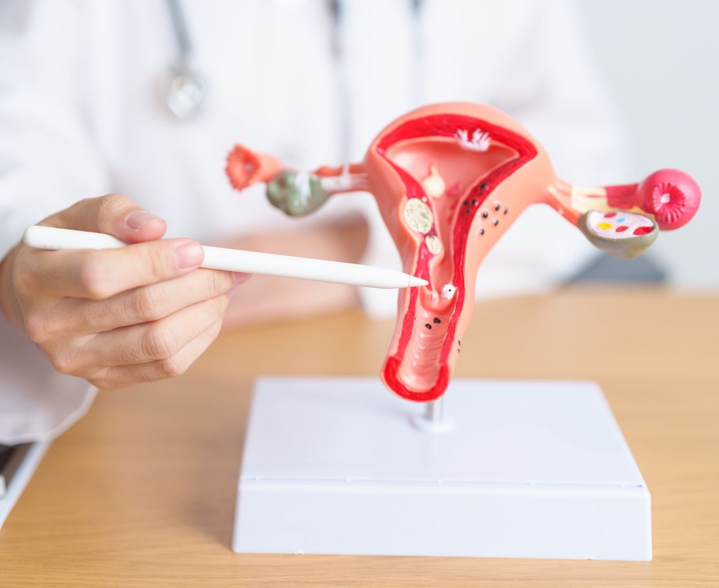 How Regular HPV Testing Can Prevent Cervical Cancer