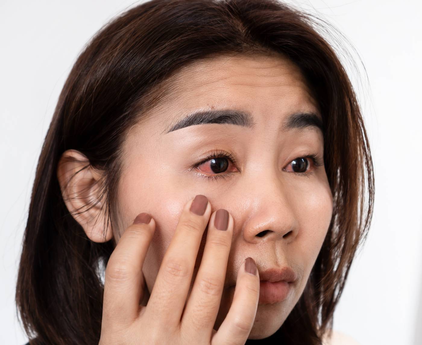 Ocular Syphilis: Symptoms, Risks, and Why Early Testing Matters