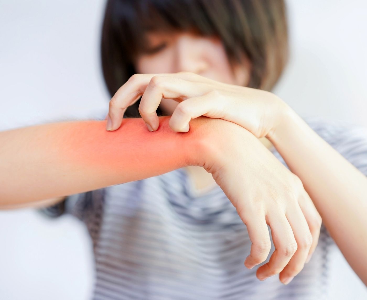 STD Rash or Something Worse? 3 Skin Conditions That Trick You