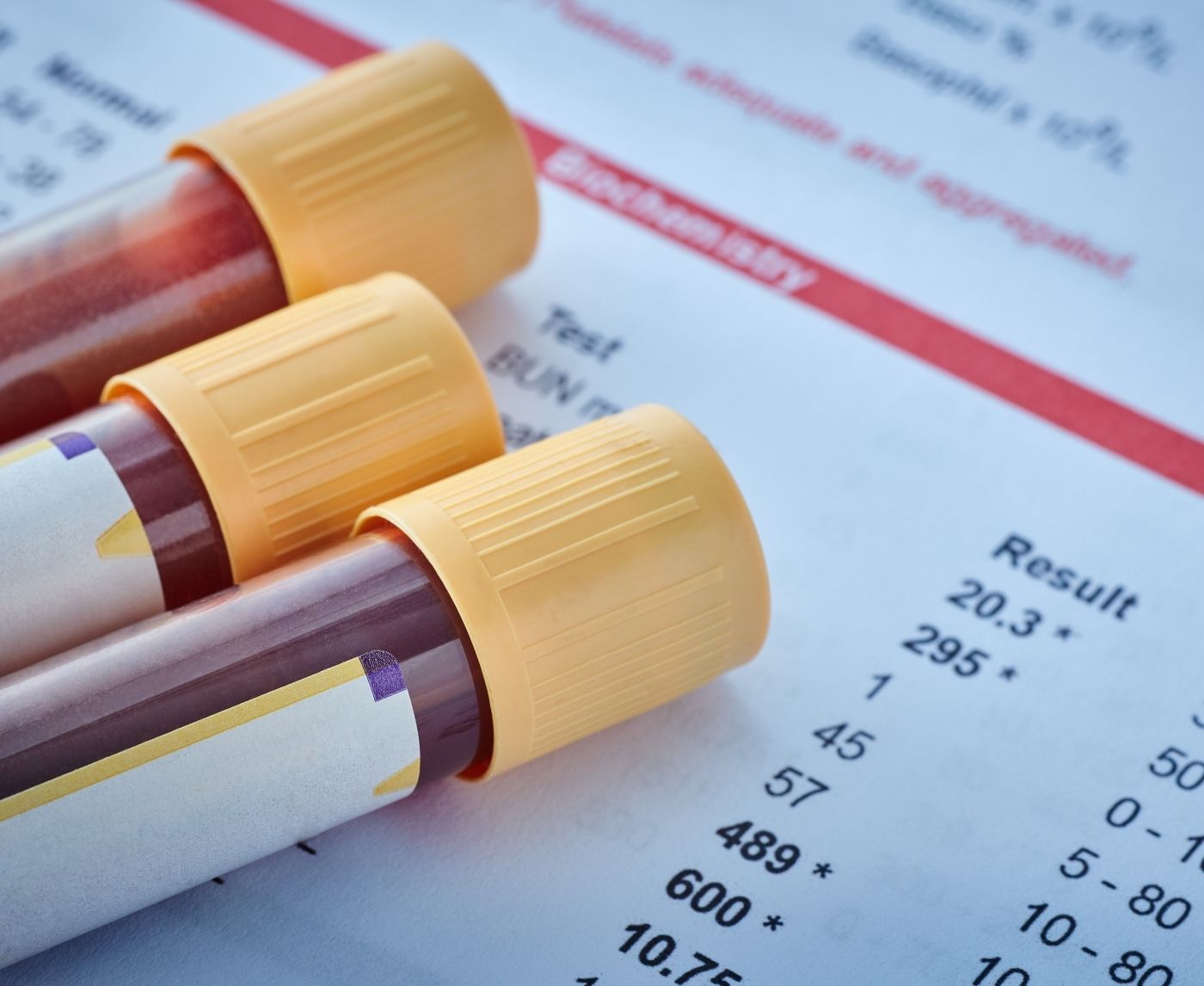 Tested Positive for Chlamydia Twice, Is It Me or My Partner?