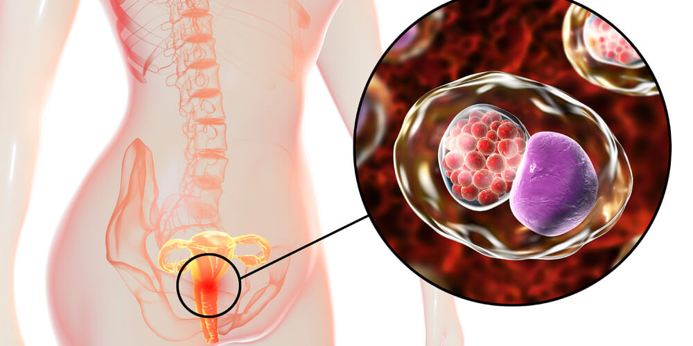 Symptoms of Chlamydia in Women