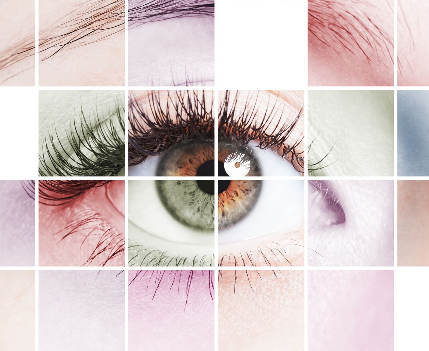 You Can Get Chlamydia in Your Eye, Here’s What It Looks Like