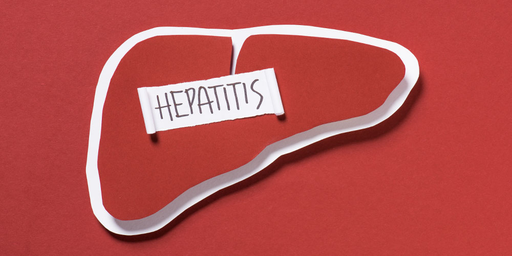 What Is Hepatitis C? Symptoms, Testing, and Treatment