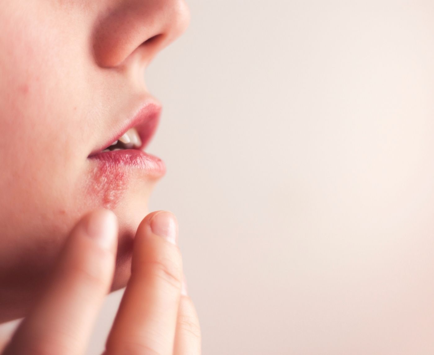 Think It’s Just a Cold Sore? Why It Might Be Genital Herpes