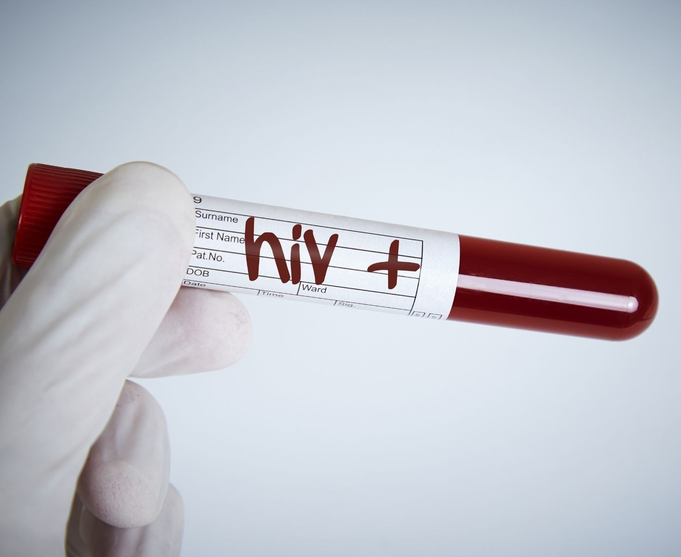 Day-by-Day HIV Symptoms: What You Might Feel After Exposure