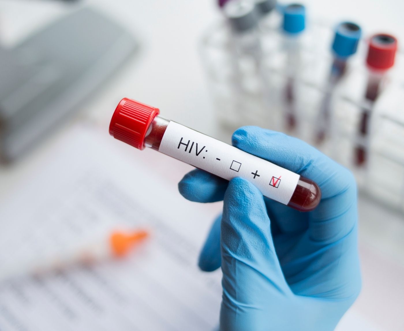 I Thought I Had AIDS. I Was Just Starting HIV Treatment