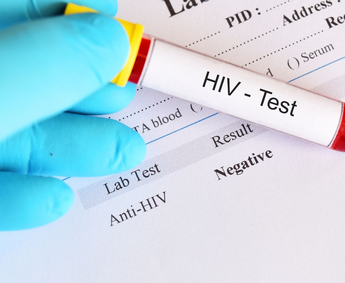 HIV Symptoms But a Negative Test? When to Try Again