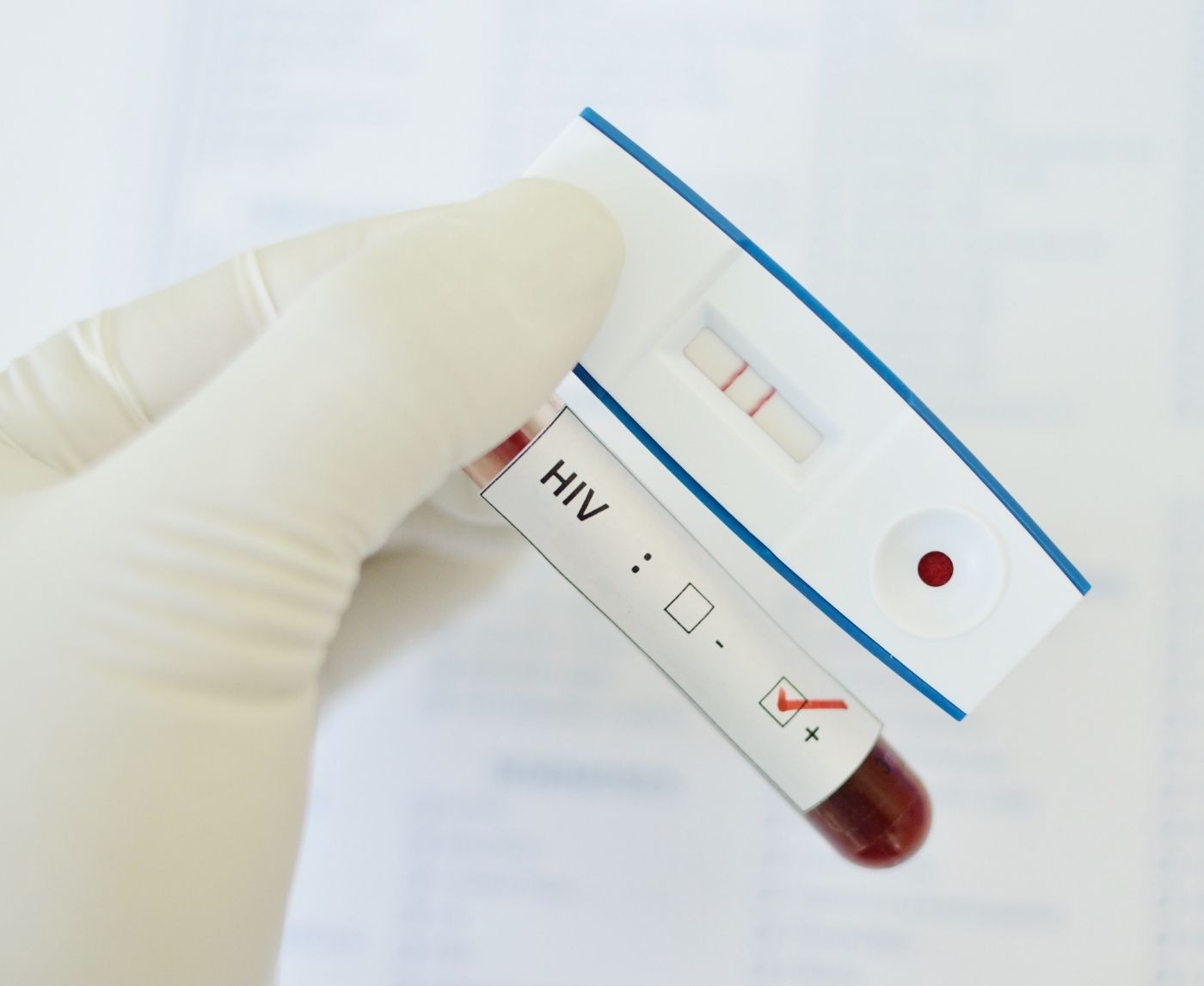 Factors Increasing the Risk of HIV and the Unspoken Link Between STDs